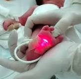 Pulsioxímetro portátil para los cuidados neonatales: lo último en tecnología de monitoreo